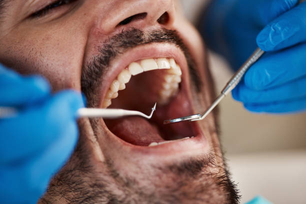 Best Emergency Dentist for Knocked-Out Tooth in USA